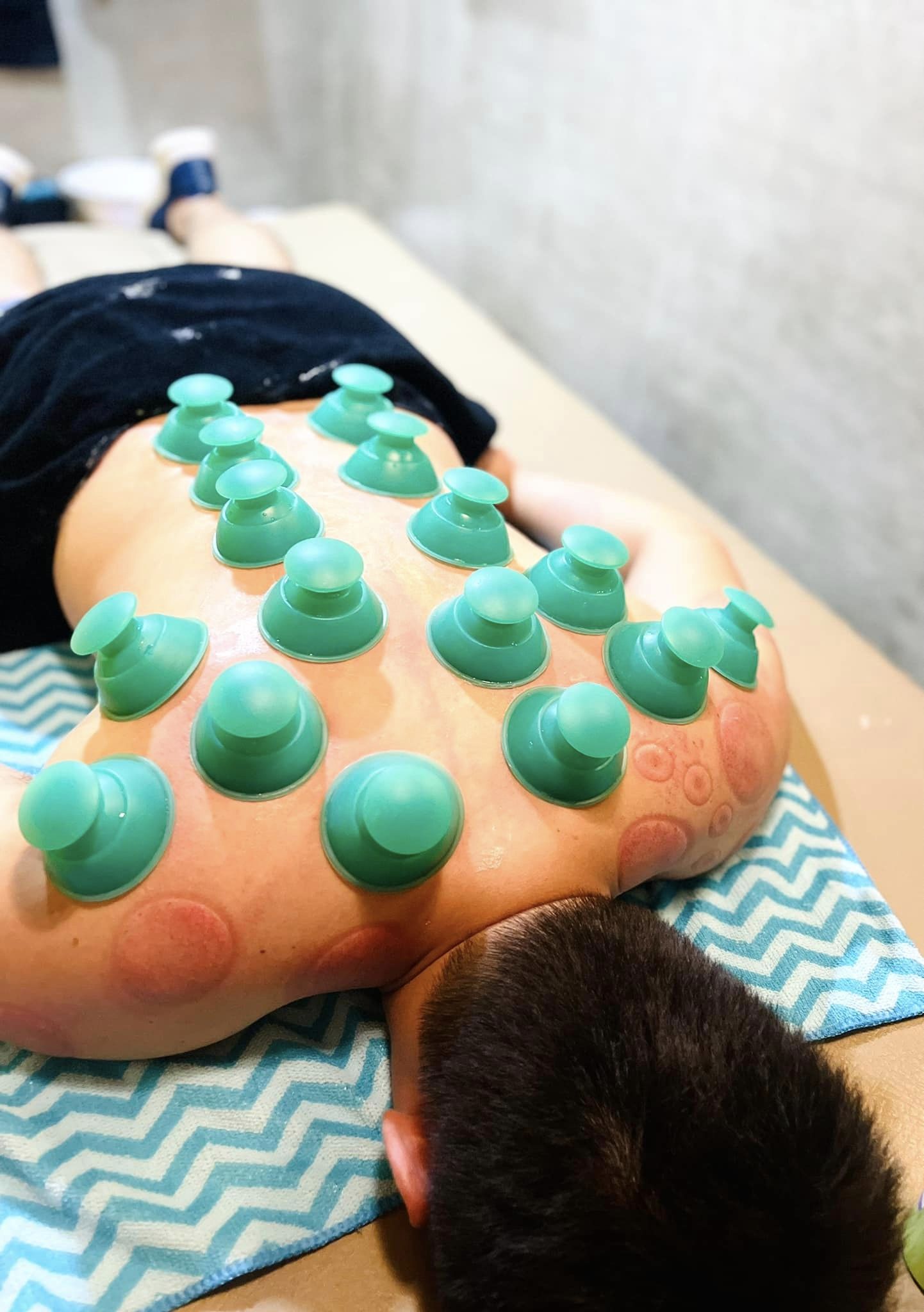 Merry Bundle- Functional IASTM and Functional Chinese Cupping (SAVE 40% OFF)